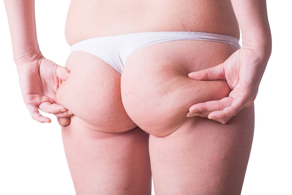 how to get rid of cellulite on your stomach